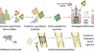 persoimplant_teaser.jpg (DE)