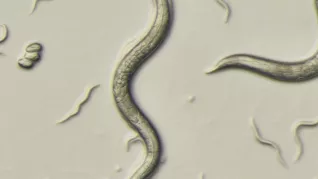 Experimental Models Caenorhabditis Elegans