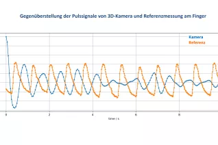 BEZ_Gegenüberstellung der Pulssignale von 3D-Kamera und Referenzmessung Finger_rPPG_1
