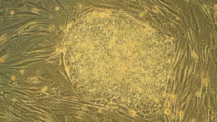 menschliche_stammzellen_mitte_und_fibroblasten_von_maeusen_teasercut_gemeinfrei.jpg (DE)