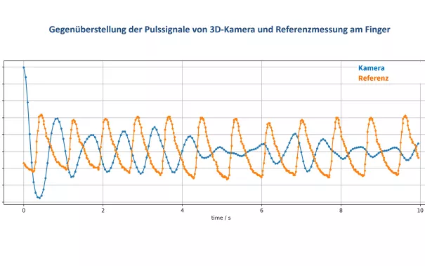 BEZ_Gegenüberstellung der Pulssignale von 3D-Kamera und Referenzmessung Finger_rPPG_1
