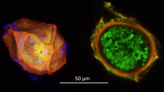 laserscan_kartoffelkrebs.jpg (DE)
