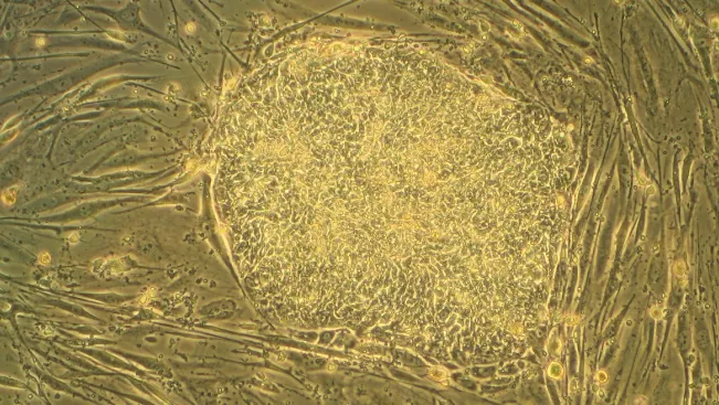 menschliche_stammzellen_mitte_und_fibroblasten_von_maeusen_teasercut_gemeinfrei.jpg (DE)