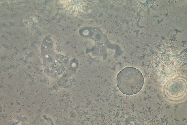 Naegleria Tropho und  Zyste_Arbeitsgruppe Scheid